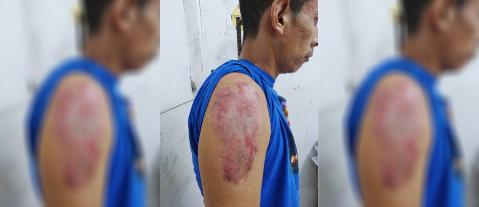 Cae peligroso gatillero de la MS-13 que quemó sus tatuajes para evitar la cárcel