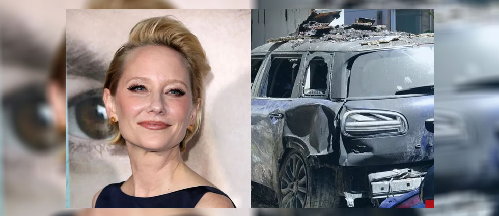 En coma la actriz Anne Heche tras chocar su auto contra una vivienda: la Policía la investiga