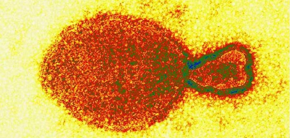 Detectan nuevo virus en China: Hay 35 casos confirmados
