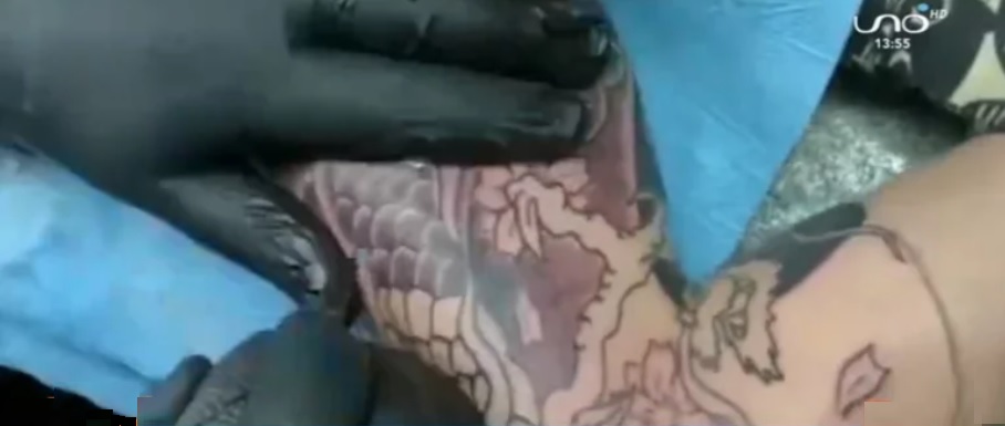 Joven podría sufrir amputación de brazo por un mal tatuaje