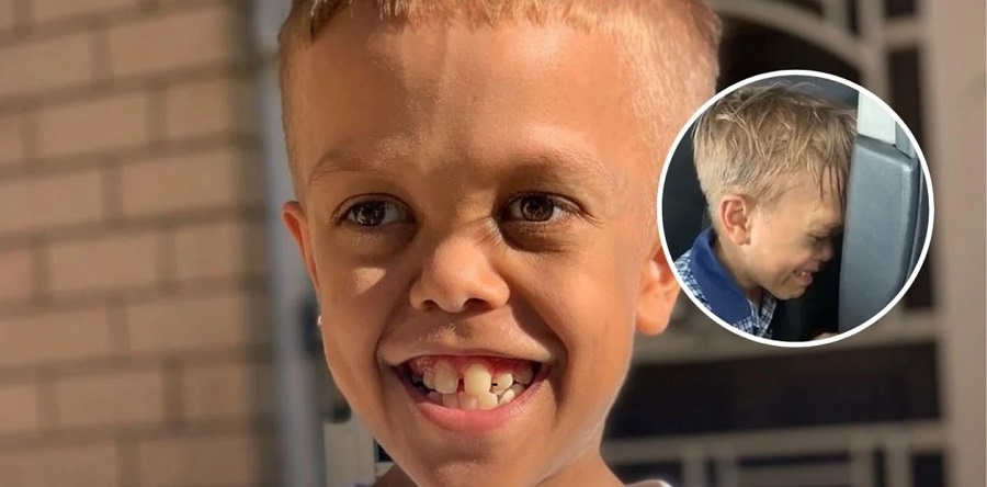 Niño con enanismo que sufrió bullying ahora destaca en película de Hollywood