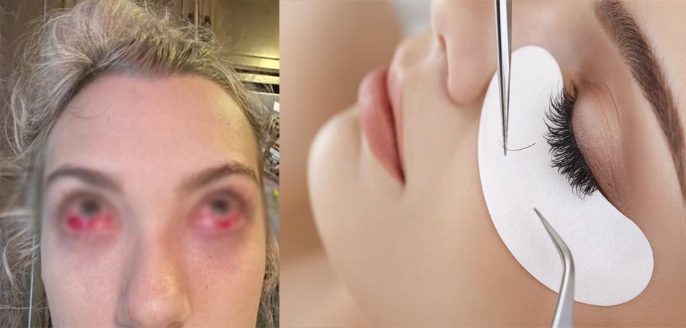 Adolescente queda con los ojos de «zombi» tras extensión de pestañas 