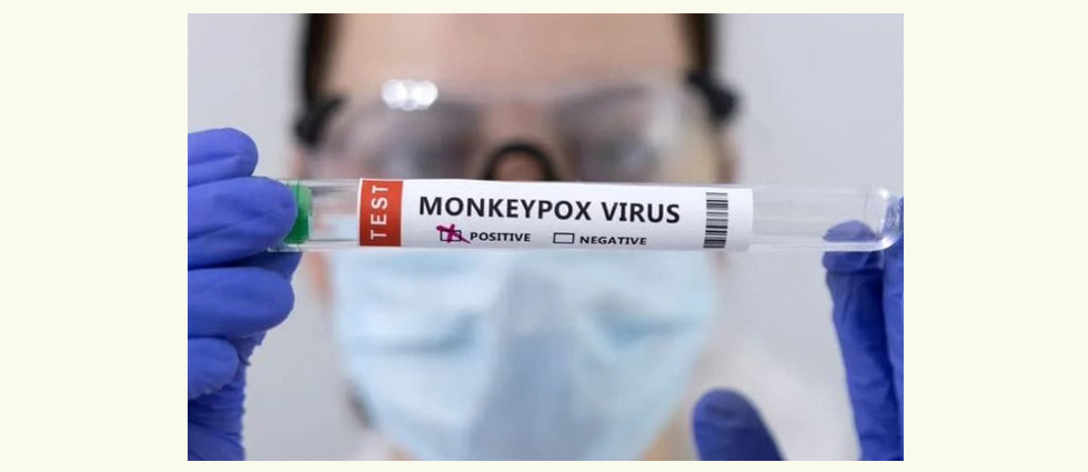 EUA registra primera muerte por viruela del mono
