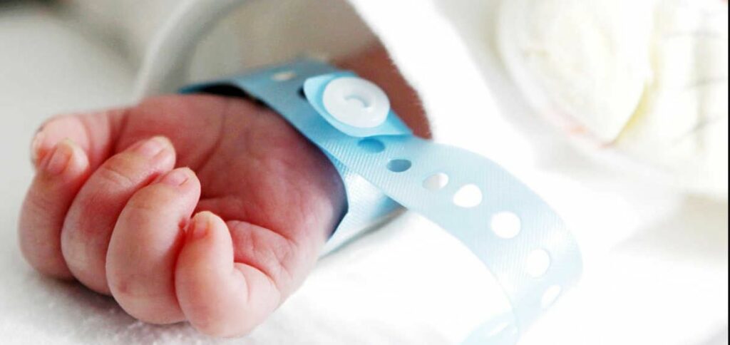 Niño nació con un cuerno en lugar de piernas