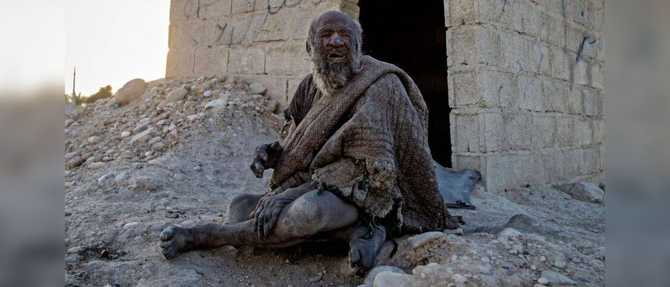 Pierde la vida el “hombre más sucio del mundo”, tenía 67 años sin bañarse