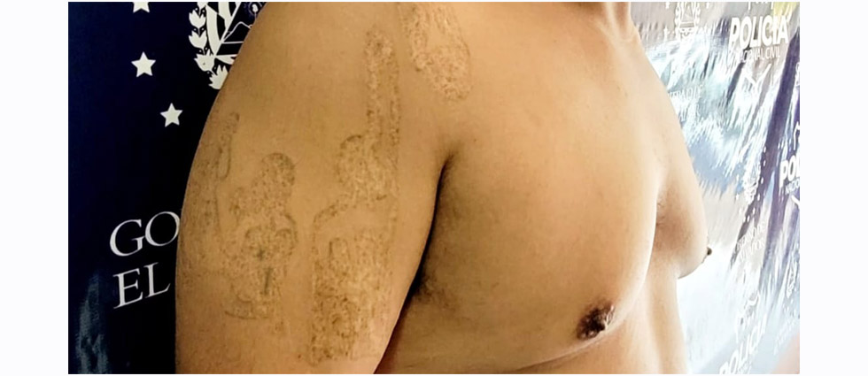 Policías arrestan a temido MS que por temor a la cárcel se quitó los tatuajes que antes presumía