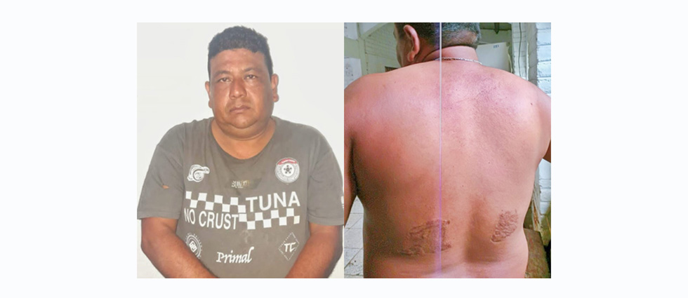 Arrestan a MS que se quemó los tatuajes para evitar la cárcel