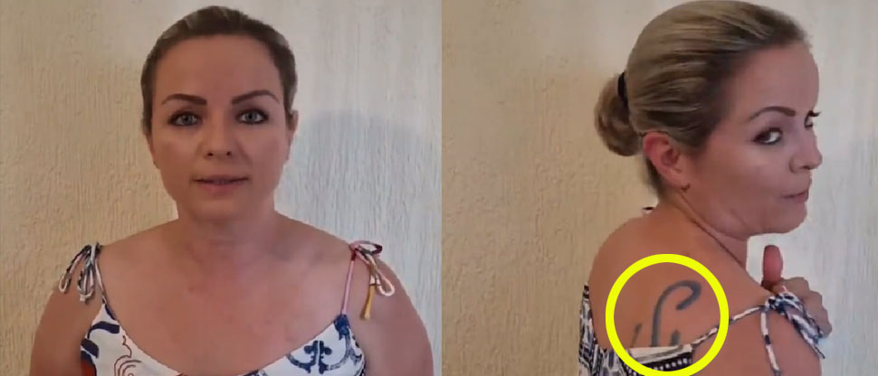 Mujer denuncia que su esposo, un notario público, la marcó con un fierro para ganado
