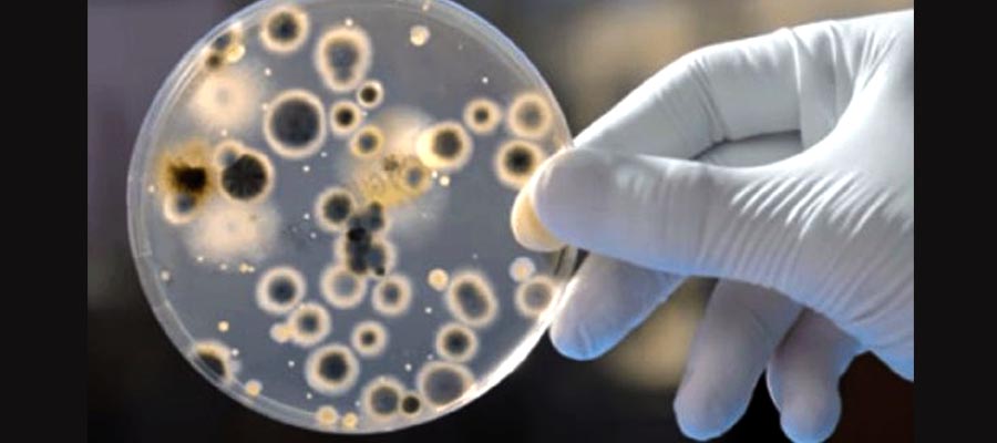 Confirman los dos primeros casos del “súper hongo” Candida auris en la Argentina