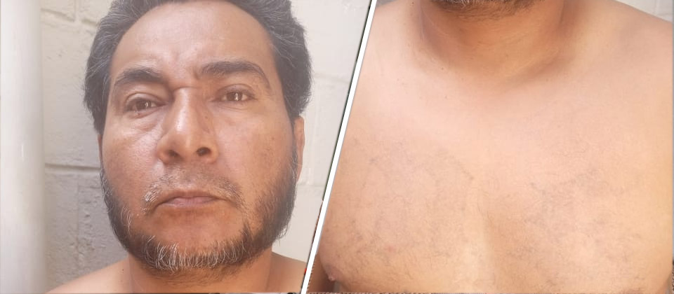 Detienen a pandillero que intentó borrarse las letras «M-S»