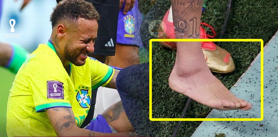 ¡ALARMA! Así &nbsp;luce el tobillo de Neymar tras lesionarse en el partido ante Serbia