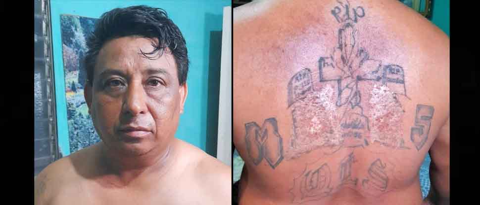 Pandillero veterano intentó quemarse sus tatuajes de la MS por temor a ser capturado