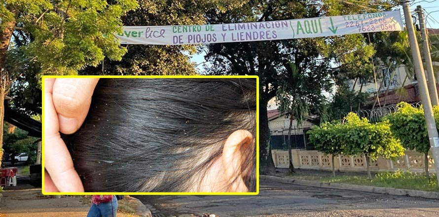 Conozca el primer Centro de Eliminación de Piojos y Liendres en S.S