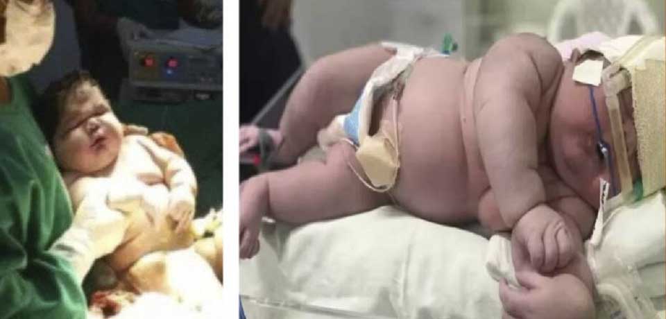 Nace «bebé gigante» de más de 15 libras y 59 centímetros