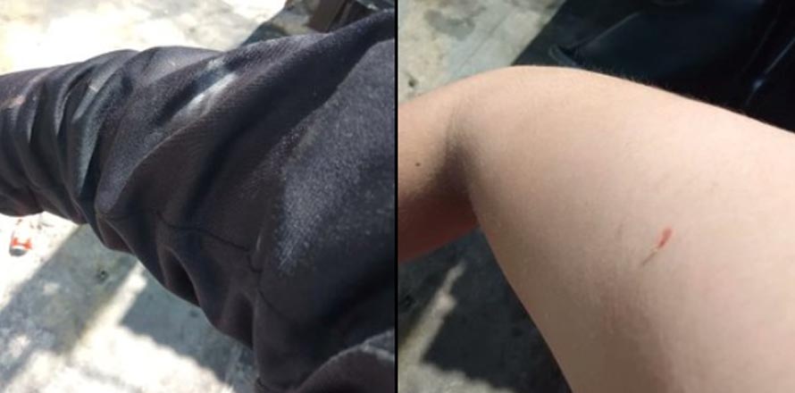Señorita biker resulta lastimada luego que un “loco” le lanzara una piedra en plena calle