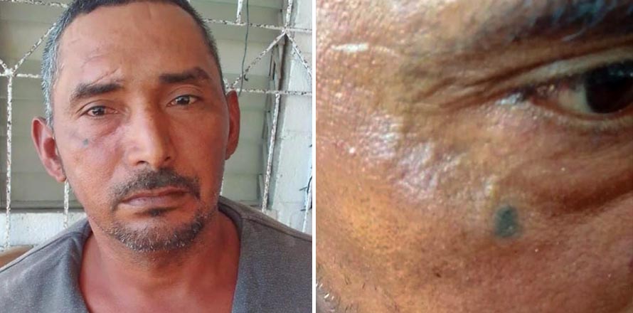 Pandillero capturado llevaba un tatuaje de lágrima debajo de su ojo; significa que ya mató
