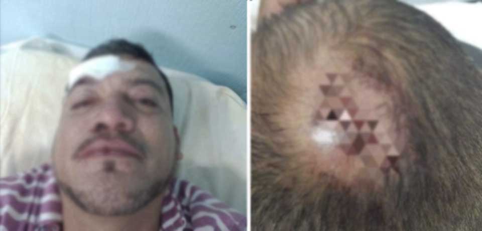Hombre termina en el hospital tras recibir varios «cacerolazos» de su esposa por una infidelidad
