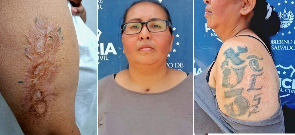Capturan en Altavista a pandillera que intentó borrar sus tatuajes