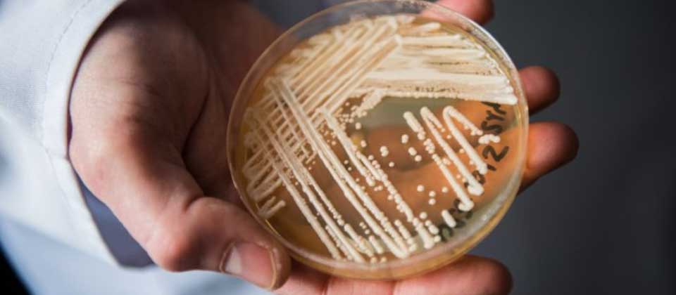 EEUU en alerta por la propagación de un hongo altamente infeccioso y mortal