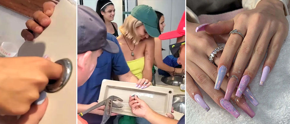 Mujer casi pierde un dedo por culpa de una de sus uñas 