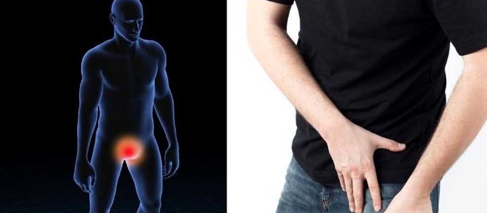 Conoce las 3 enfermedades que puede padecer un hombre en sus testículos
