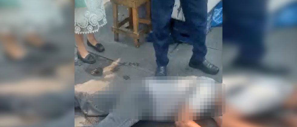 Hombre en estado de ebriedad tropieza y se lleva un buen golpe en la cabeza 