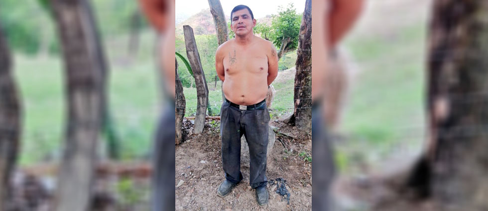 Capturan a MS-13 que intentó borrarse tatuajes que antes presumía