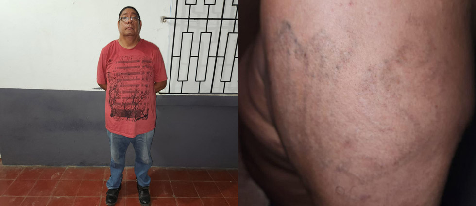 Capturan a señor que desde hace años es parte de la MS-13 y que en vano se borró los tatuajes