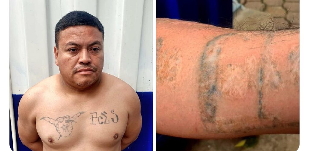 Alias Chucky sufrió para borrar sus tatuajes de la mara y terminó detenido