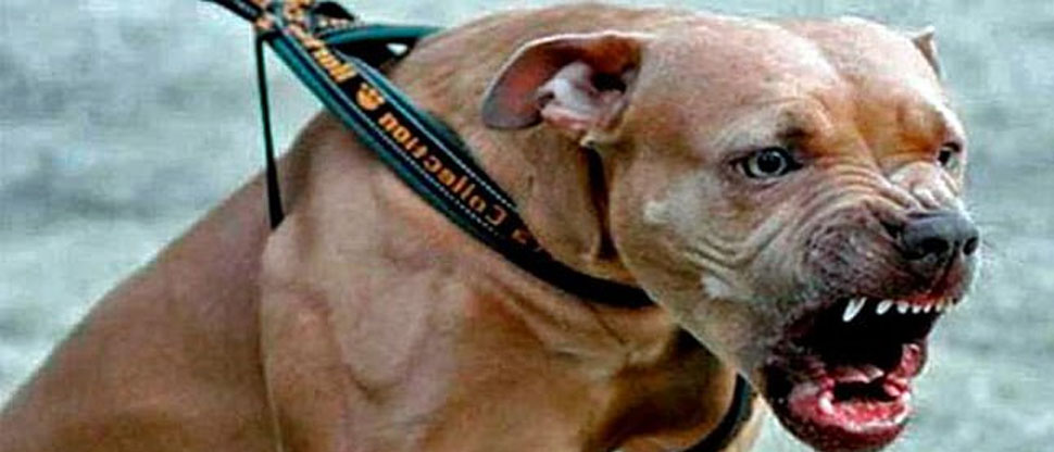 Mujer pierde brazos y piernas tras brutal ataque de pitbulls