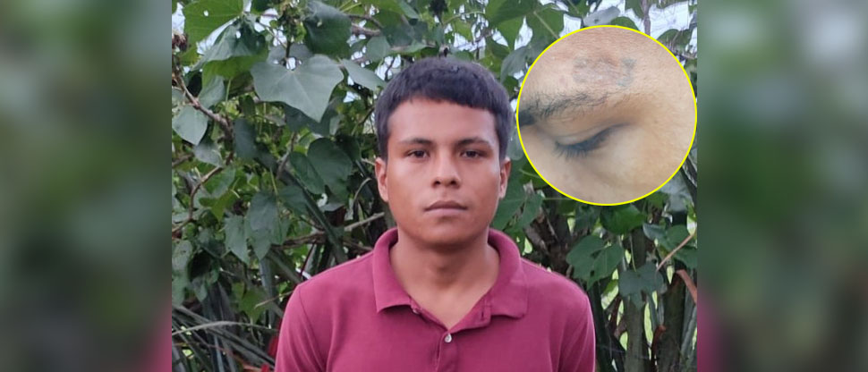 Intentó ocultar su tatuaje de la MS, pero terminó bajo arresto en Ilobasco