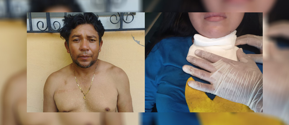 Sujeto que hirió a niña por negarse a ser su pareja también la raptó y la hizo pasar por su hija