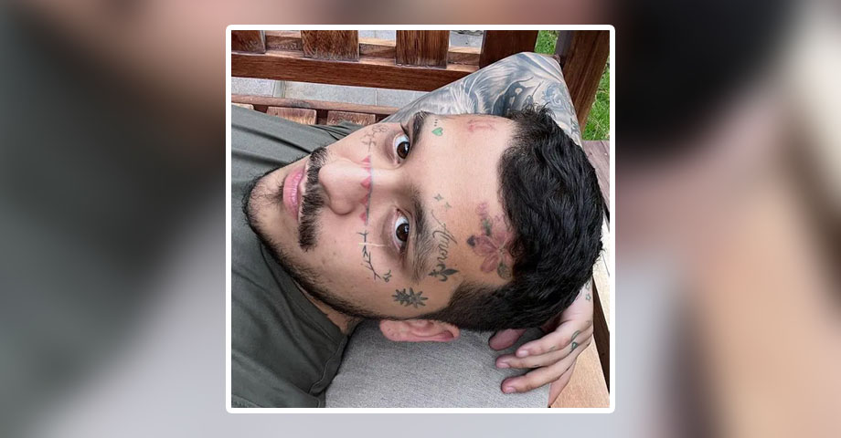 Christian Nodal se somete a tratamiento para eliminar tatuajes de su rostro