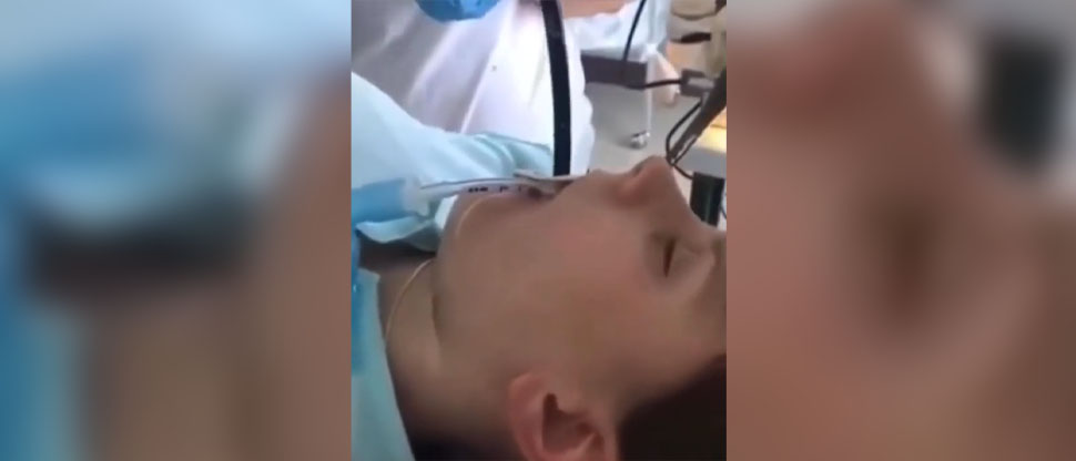 VIDEO: Médicos sacan una serpiente de la boca de una mujer