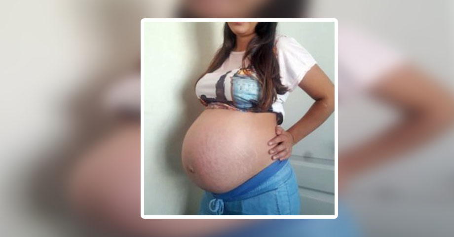 Joven creyó que estaba embarazada, pero en realidad tenía un enorme tumor