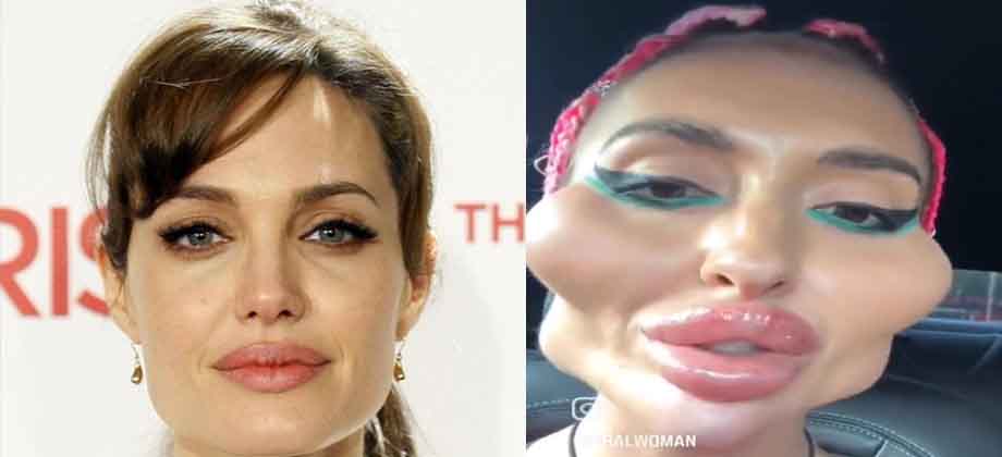 Mujer se desfigura el rostro con tal de “parecerse” a Angelina Jolie