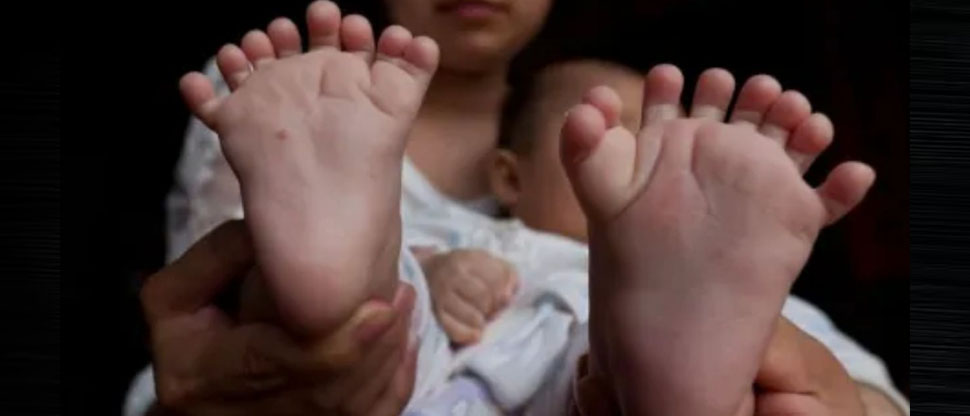 Bebé nace con 26 dedos y sus padres creen que es la reencarnación de una diosa