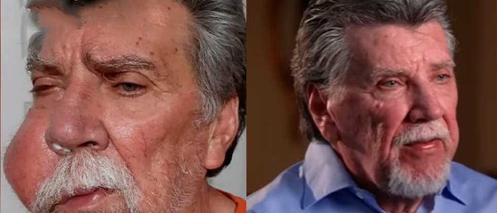 Tumor se disuelve milagrosamente en rostro de hombre tras oraciones