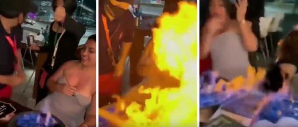 Joven se incendia en pleno festejo de cumpleaños