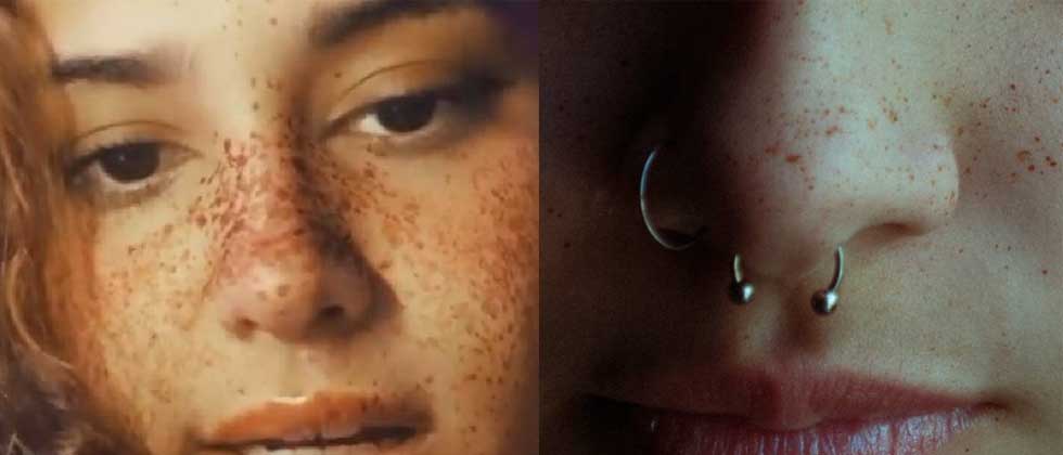 Piercing en la nariz deja parapléjica a joven de 15 años