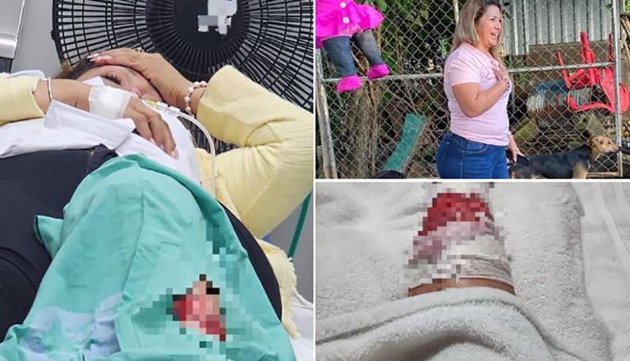 Perro muerde a diputada de ARENA en La Paz