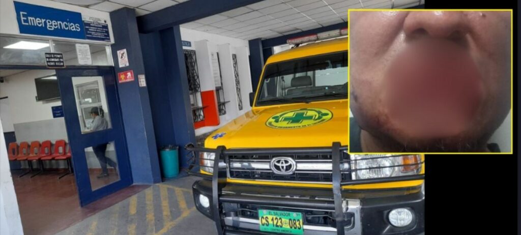Perro ataca a un hombre y un niño de 3 años en Apopa: Le arrancó parte del labio