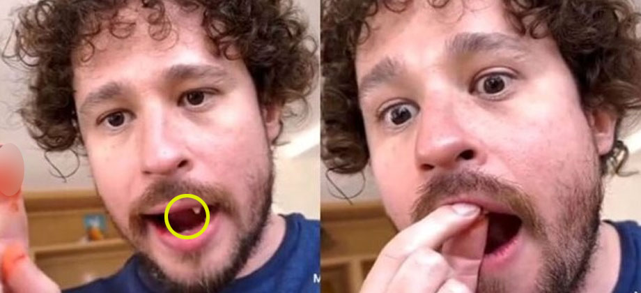 Luisito Comunica pierde dos dientes durante una transmisión