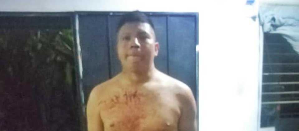 Detienen a conductor de provocar múltiple accidente frente a centro hospitalario
