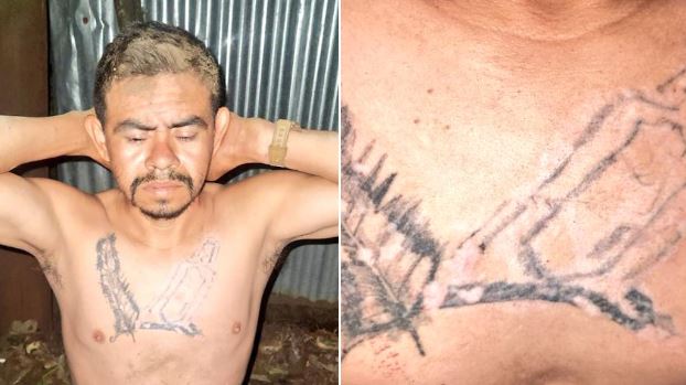 Capturan a pandillero que intentó borrar sus tatuajes de la 18