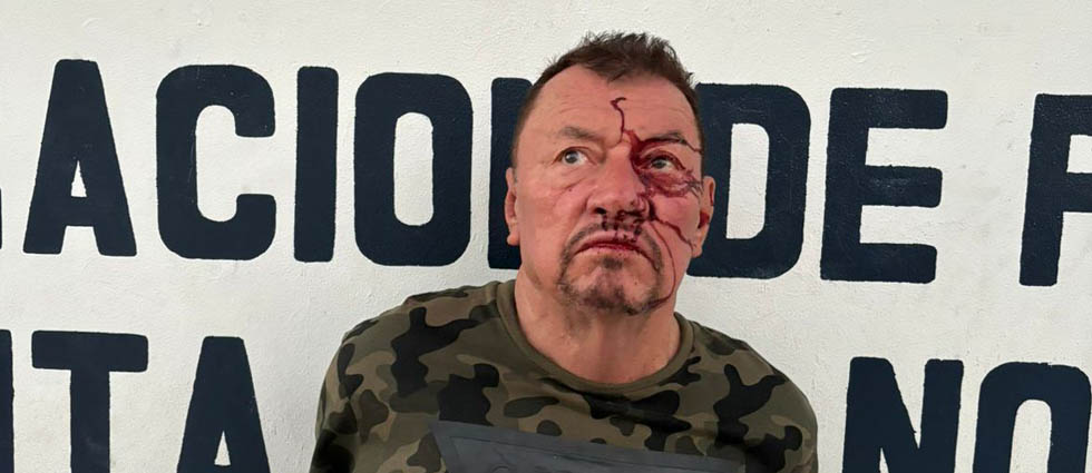 Sujeto le disparó a un hombre mientras bebían alcohol en Santa Ana