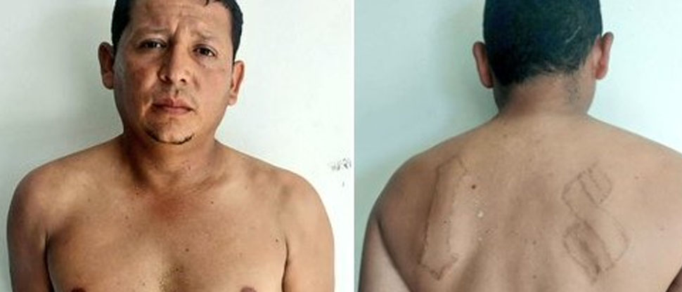 Quemó el tatuaje de su pandilla por miedo a ser capturado