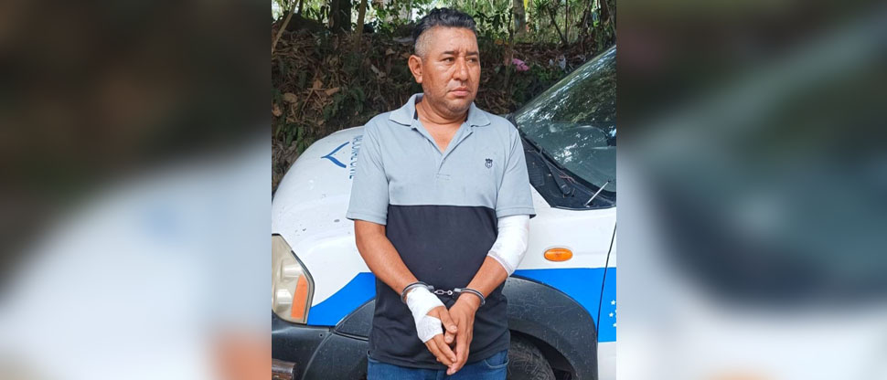 Motociclista y su acompañante sufren fuerte accidente provocado por el consumo de licor