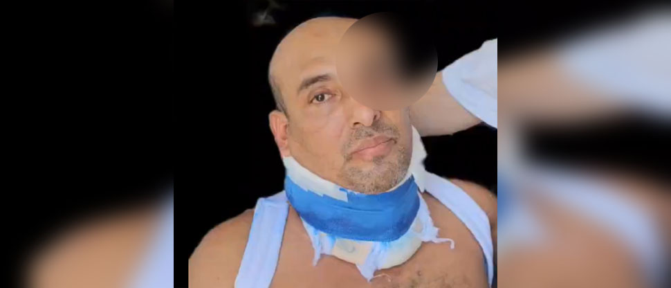 Omar Angulo comparte momento cuando le drenan el edema que tiene en la cabeza 