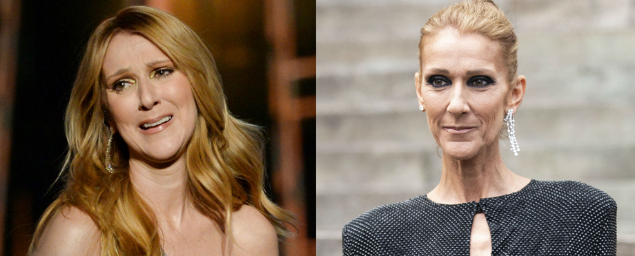 Solo un milagro puede salvar a Céline Dion